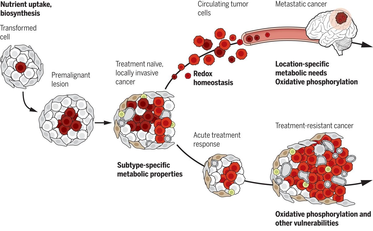 Understanding Cancer Glucose Metabolism: